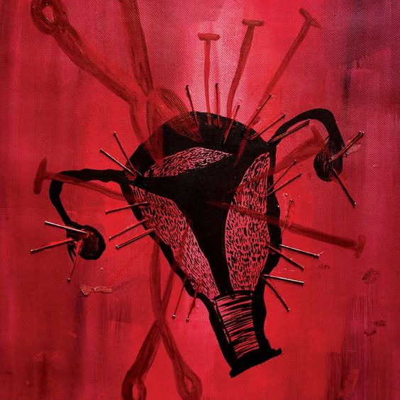 Affrontare l'endometriosi: un'analisi più approfondita della patologia tra le opzioni terapeutiche e le nuove prospettive future